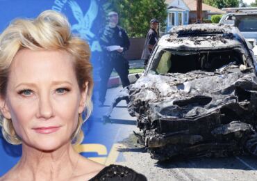Hvězda Policie Chicago je po nehodě v extrémně kritickém stavu: Anne Heche má strašlivé popáleniny, ale bojuje
