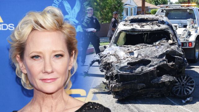 Hvězda Policie Chicago je po nehodě v extrémně kritickém stavu: Anne Heche má strašlivé popáleniny, ale bojuje