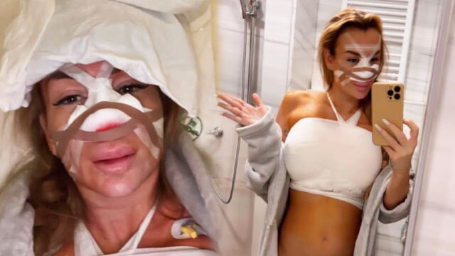 Královna plastik Eva Feuereislová podstoupila tři náročné zákroky najednou: Museli ji spravit i tam dole