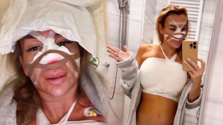 Královna plastik Eva Feuereislová podstoupila tři náročné zákroky najednou: Museli ji spravit i tam dole