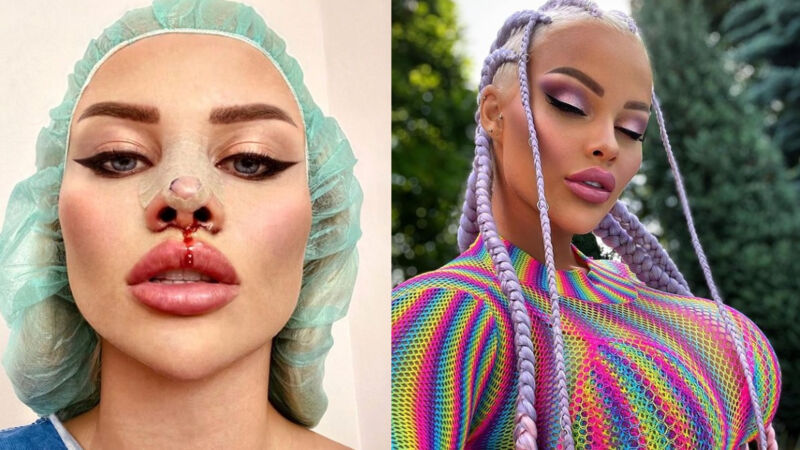První česká Barbie Gabriel Jiráčková má za sebou další plastiku: Nosík ve tvaru diamantu jako od Mattela