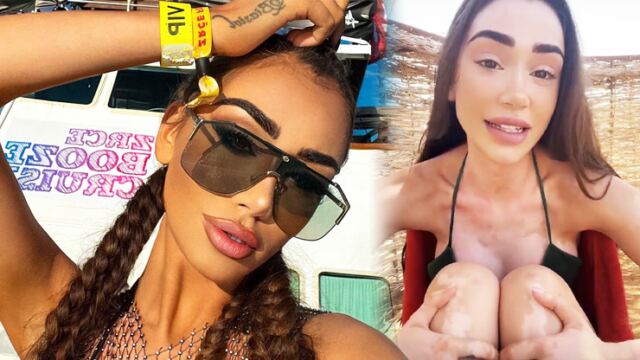 Veronica Biasiol se slzami v očích přiznala nemoc, kterou roky skrývala: Už to nechci tajit vzkázala