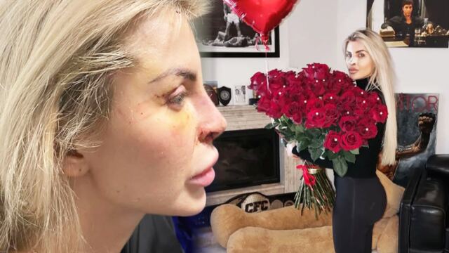 Lela Vémola se pochlubila výsledkem práce íránských chirurgů: Fungl nový nosík sklízí obdiv
