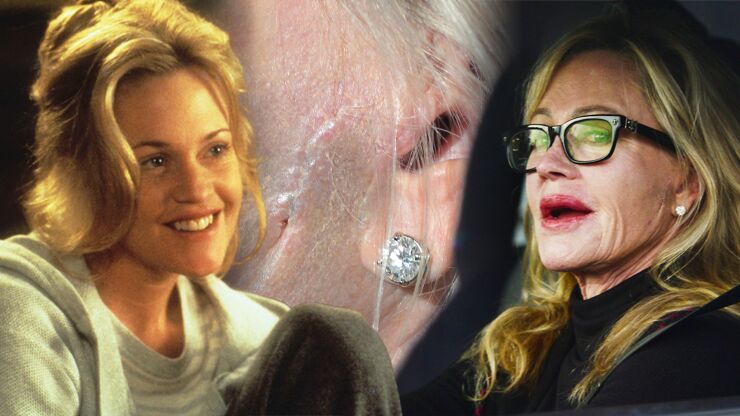 Melanie Griffith ukázala ošklivou jizvu po rakovině kůže: Pro všechny, kteří se rádi opalují, má jasný vzkaz