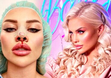 Milovnice plastické chirurgie Gabriel Jiráčková: Jak by vypadala, kdyby ze dne na den přestala se všemi zákroky?