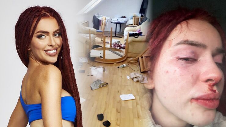 Rachel si před Love Island prošla peklem: Bývalý partner ji kopal, fackoval a násilím cpal prsty do intimních míst
