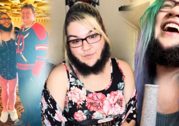 Kotlety na obličeji se jí poprvé objevily ve 12 letech: Influencerka s plnovousem se snaží bořit mýty o kráse