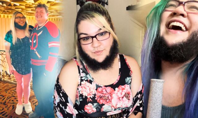 Kotlety na obličeji se jí poprvé objevily ve 12 letech: Influencerka s plnovousem se snaží bořit mýty o kráse