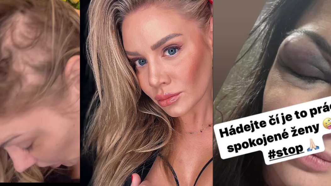 Dívčí válka: Influencerka Michaela Jonáš popsala brutální napadení, vláčeli mě po asfaltu a vytrhali vlasy