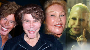 Plastikové obludárium: 4 celebrity, které si zdevastovaly obličej a nejsou si vůbec podobné