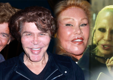 Plastikové obludárium: 4 celebrity, které si zdevastovaly obličej a nejsou si vůbec podobné