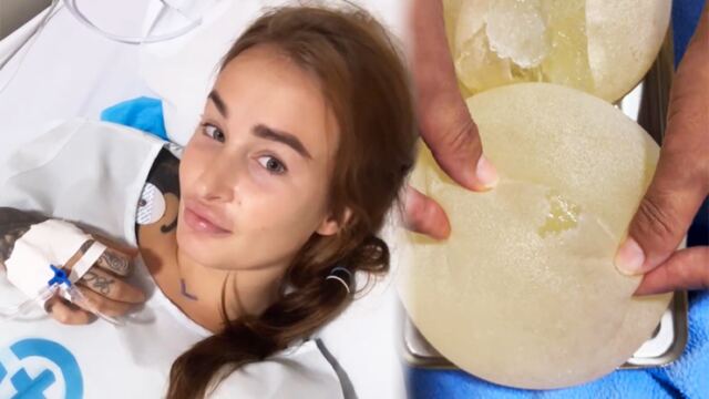 Tělo Daisy Lee odmítlo silikony, ty praskly a musely ven: Teď budou vytahaná a svislá, pláče