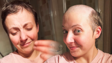 Anička Slováčková bojuje s rakovinou jako lvice: Ukázala chomáče vlasů a vedlejší účinky léčby