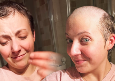 Anička Slováčková bojuje s rakovinou jako lvice: Ukázala chomáče vlasů a vedlejší účinky léčby